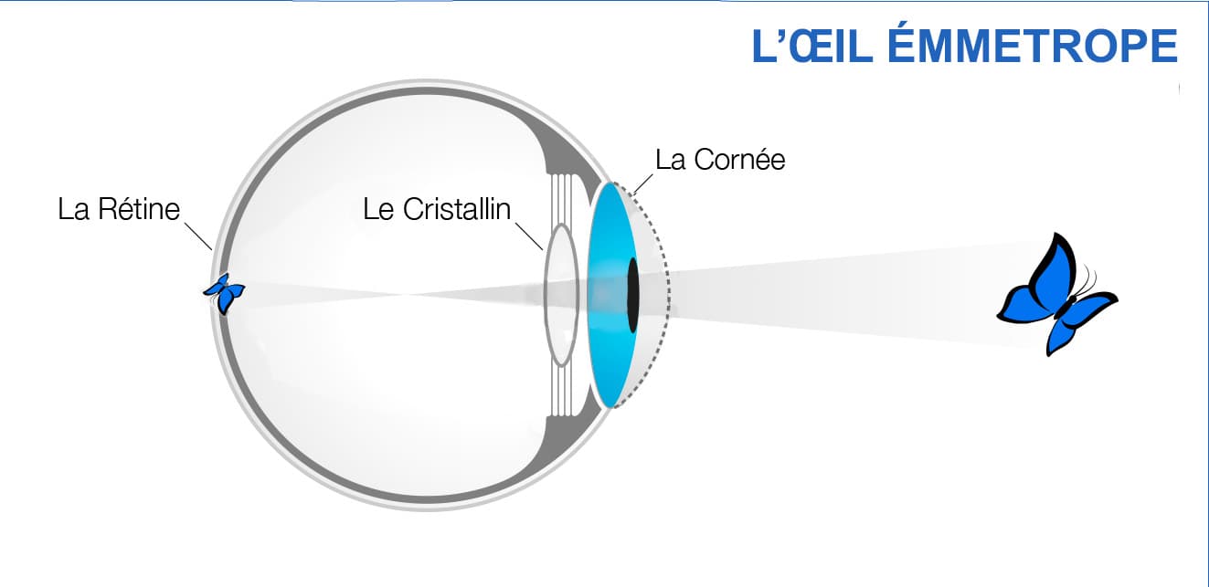 oeil normail