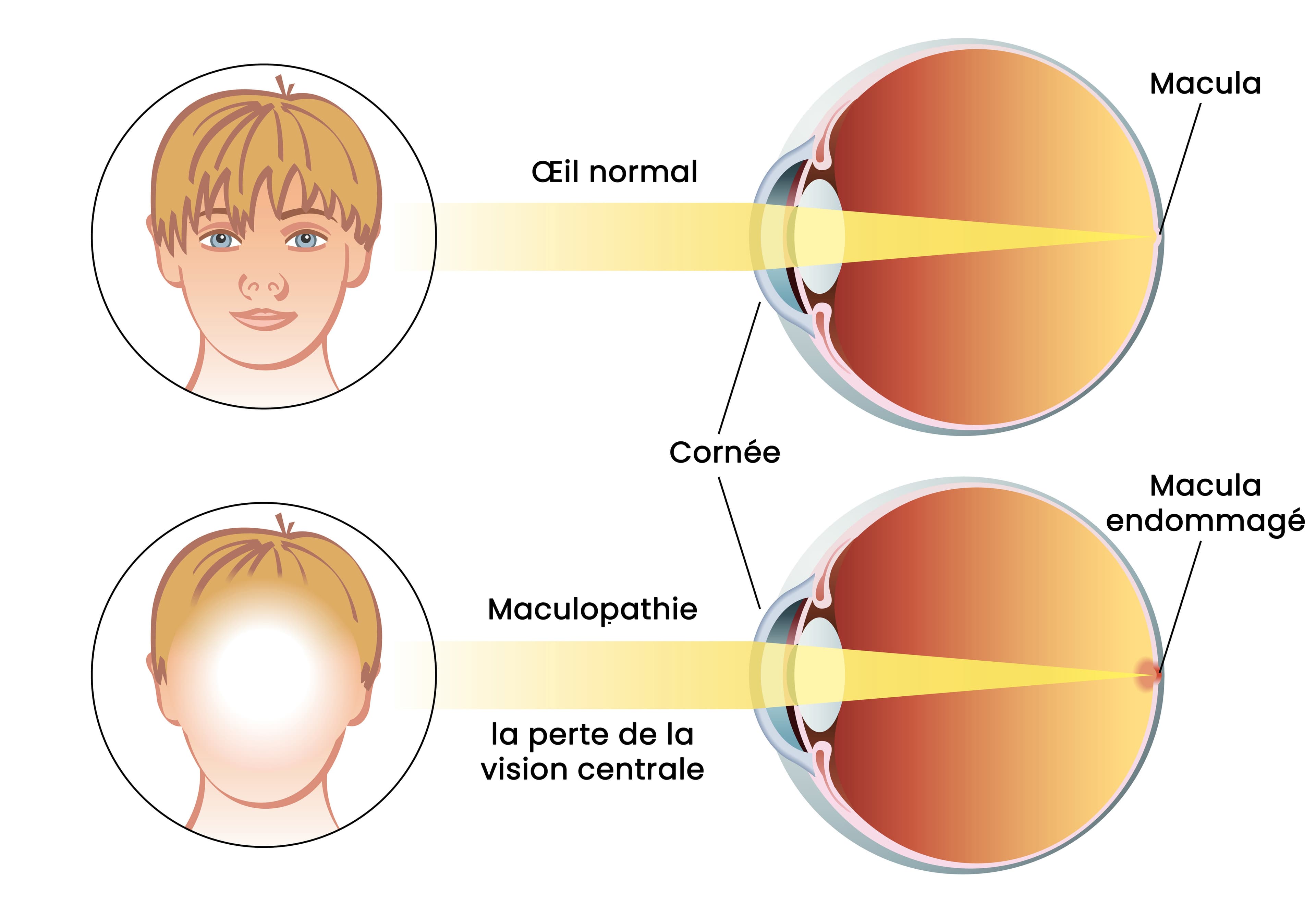 Macula-explication