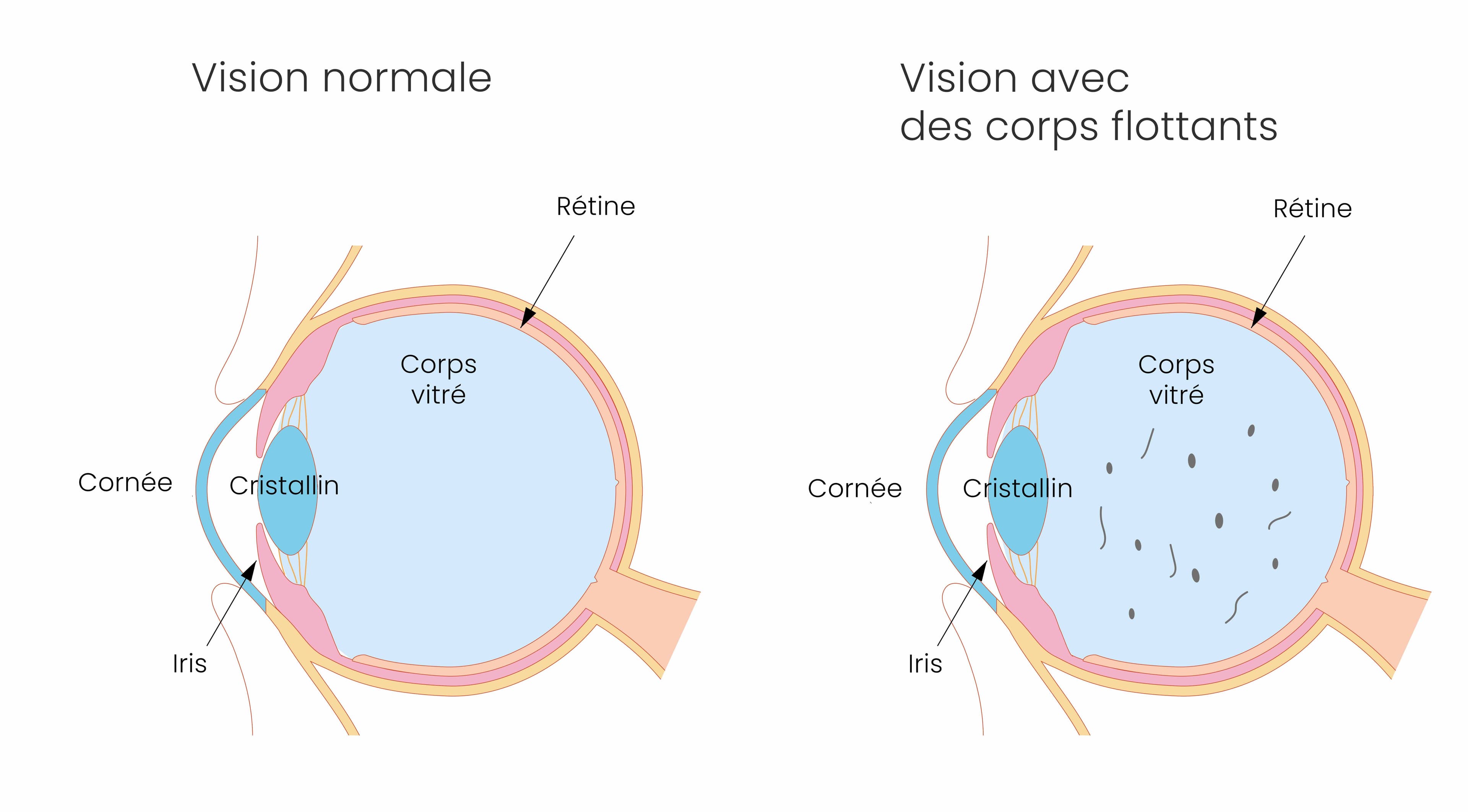 Exemple corps flottants 2